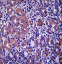 B4GALNT3 Antibody - B4GALNT3 Antibody immunohistochemistry of formalin-fixed and paraffin-embedded human stomach tissue followed by peroxidase-conjugated secondary antibody and DAB staining.