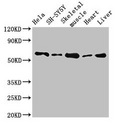 B4GALT2 Antibody - Western Blot Positive WB detected in: Hela whole cell lysate, SH-SY5Y whole cell lysate, Mouse skeletal muscle tissue, Rat heart tissue, Rat liver tissue All lanes: ASNS antibody at 2.7µg/ml Secondary Goat polyclonal to rabbit IgG at 1/50000 dilution Predicted band size: 65, 63, 55 kDa Observed band size: 65 kDa