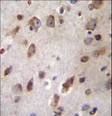 B4GAT1 / B3GNT1 Antibody - B3GNT1 Antibody immunohistochemistry of formalin-fixed and paraffin-embedded human brain tissue followed by peroxidase-conjugated secondary antibody and DAB staining.