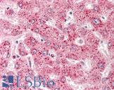B9D1 Antibody - Human Liver: Formalin-Fixed, Paraffin-Embedded (FFPE)