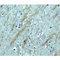 BACE1 / BACE Antibody - Immunohistochemistry of BACE in mouse brain tissue with BACE antibody at 2.5 µg/ml.