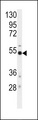 BACE1 / BACE Antibody - Western blot of anti-BACE Antibody (S498) in mouse cerebellum tissue lysates (35 ug/lane). BACE (arrow) was detected using the purified antibody.