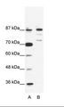 BACH1 Antibody - A: Marker, B: Jurkat Cell Lysate.  This image was taken for the unconjugated form of this product. Other forms have not been tested.