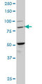 BACH1 Antibody - BACH1 monoclonal antibody (M02), clone 1B8 Western Blot analysis of BACH1 expression in NIH/3T3.