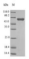 mdh / Malate Dehydrogenase Protein - (Tris-Glycine gel) Discontinuous SDS-PAGE (reduced) with 5% enrichment gel and 15% separation gel.