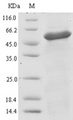 UGL Protein - (Tris-Glycine gel) Discontinuous SDS-PAGE (reduced) with 5% enrichment gel and 15% separation gel.