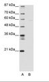 BAF60C / SMARCD3 Antibody - A: Marker, B: 293T Cell Lysate.  This image was taken for the unconjugated form of this product. Other forms have not been tested.