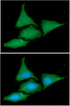 BAG2 Antibody - ICC/IF analysis of BAG2 in HeLa cells line, stained with DAPI (Blue) for nucleus staining and monoclonal anti-human BAG2 antibody (1:100) with goat anti-mouse IgG-Alexa fluor 488 conjugate (Green).