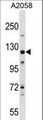 BAG6 / G3 / Scythe Antibody - BAT3 Antibody western blot of A2058 cell line lysates (35 ug/lane). The BAT3 antibody detected the BAT3 protein (arrow).