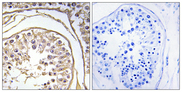 BAGE2 Antibody - Immunohistochemistry analysis of paraffin-embedded human testis, using BAGE2 Antibody. The picture on the right is blocked with the synthesized peptide.