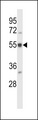 BAIAP2L2 Antibody - BAIAP2L2 Antibody western blot of HL-60 cell line lysates (35 ug/lane). The BAIAP2L2 antibody detected the BAIAP2L2 protein (arrow).