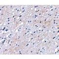 BAIAP3 Antibody - Immunohistochemical staining of human brain tissue using BAP3 antibody at 2.5 µg/mL.