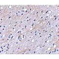 BAIAP3 Antibody - Immunohistochemical staining of human brain tissue using BAP3 antibody at 5 µg/mL.