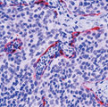 BAK1 / BAK Antibody - Formalin-fixed, paraffin-embedded human tonsil stained with peroxidase-conjugate and AEC chromogen. Note cytoplasmic staining of mucosal epithelial cells. This image was taken for the unmodified form of this product. Other forms have not been tested.