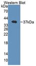 Band 4.1 / EPB41 Antibody - Western blot of Band 4.1 / EPB41 antibody with recombinant EBP41.