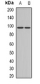 Band 4.1 / EPB41 Antibody - Western blot analysis of EPB41 expression in 22RV1 (A); HepG2 (B) whole cell lysates.