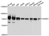 BANK1 / BANK Antibody - Western blot analysis of extracts of various cell lines, using BANK1 antibody at 1:1000 dilution. The secondary antibody used was an HRP Goat Anti-Rabbit IgG (H+L) at 1:10000 dilution. Lysates were loaded 25ug per lane and 3% nonfat dry milk in TBST was used for blocking. An ECL Kit was used for detection and the exposure time was 3s.