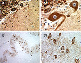 BAR / BFAR Antibody - Formalin-fixed, paraffin-embedded tissue sections of normal human brain stained for BAR expression using Polyclonal Antibody to BAR at 1:2000. A, A1: Cerebellum. B, B1: Medulla. A1 and B1 are higher magnifications of A and B, respectively.
