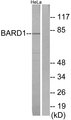BARD1 Antibody - Western blot analysis of lysates from HeLa cells, using BARD1 Antibody. The lane on the right is blocked with the synthesized peptide.