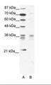 BARX1 Antibody - A: Marker, B: Jurkat Cell Lysate.  This image was taken for the unconjugated form of this product. Other forms have not been tested.