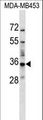 BATF2 / SARI Antibody - BATF2 Antibody western blot of MDA-MB453 cell line lysates (35 ug/lane). The BATF2 antibody detected the BATF2 protein (arrow).