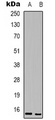 BATF3 Antibody - Western blot analysis of BATF3 expression in mouse lung (A); mouse spleen (B) whole cell lysates.