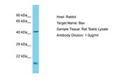 BAX Antibody -  This image was taken for the unconjugated form of this product. Other forms have not been tested.