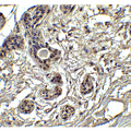 BBC3 / PUMA Antibody - Immunohistochemistry of PUMA in human breast tissue with PUMA antibody at 2.5 µg/ml.