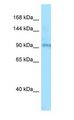 BBS9 Antibody - BBS9 antibody Western Blot of Jurkat.  This image was taken for the unconjugated form of this product. Other forms have not been tested.