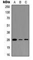 BCAP31 / BAP31 Antibody - Western blot analysis of BAP31 expression in Ramos (A); MCF7 (B); HEK293T (C) whole cell lysates.