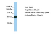 BCAR1 / p130Cas Antibody -  This image was taken for the unconjugated form of this product. Other forms have not been tested.