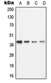BCAT1 / ECA39 Antibody - Western blot analysis of ECA39 expression in Jurkat (A); Ramos (B); NIH3T3 (C); PC12 (D) whole cell lysates.