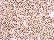 BCCIP Antibody - BCCIP antibody detects BCCIP protein at nucleus on BT483 xenograft by immunohistochemical analysis. Sample: Paraffin-embedded BT483 xenograft. BCCIP antibody dilution:1:500.