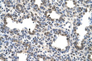 BCHE / Cholinesterase Antibody - BCHE antibody ARP44208_T100-NP_000046-BCHE(butyrylcholinesterase) Antibody IHC of formalin-fixed, paraffin-embedded human Lung. Positive label: Alveolar cells indicated with arrows. Antibody concentration 4-8 ug/ml. Magnification 400X.  This image was taken for the unconjugated form of this product. Other forms have not been tested.