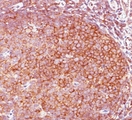 BCL10 / BCL-10 Antibody - Bcl10 antibody BL10/411 immunohistochemistry tonsil.  This image was taken for the unmodified form of this product. Other forms have not been tested.
