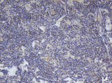 BCL10 / BCL-10 Antibody - IHC of paraffin-embedded Human lymphoma tissue using anti-BCL10 mouse monoclonal antibody.