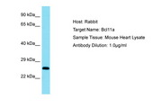 BCL11A Antibody -  This image was taken for the unconjugated form of this product. Other forms have not been tested.