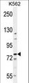BCL11B Antibody - BCL11B Antibody western blot of K562 cell line lysates (35 ug/lane). The BCL11B antibody detected the BCL11B protein (arrow).