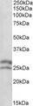 BCL2 / Bcl-2 Antibody - Goat Anti-BCL2 Antibody (0.1µg/ml) staining of Human Lymph lysate (35µg protein in RIPA buffer). Primary incubation was 1 hour. Detected by chemiluminescencence.