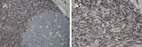 BCL2 / Bcl-2 Antibody - Formalin-fixed paraffin-embedded section from a secondary follicle of the mouse lymph node stained for Bcl-2 expression using Polyclonal Antibody to Bcl-2 at 1:2000. A, Abundant staining is seen in the mantle zone, and little staining is seen in the germinal center. A1 is a higher magnification of A.
