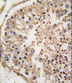 BCL2 / Bcl-2 Antibody - Formalin-fixed and paraffin-embedded human testis tissue reacted with Bcl-2 BH3 Domain Antibody, which was peroxidase-conjugated to the secondary antibody, followed by DAB staining. This data demonstrates the use of this antibody for immunohistochemistry; clinical relevance has not been evaluated.