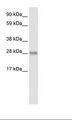 BCL2L1 / BCL-XL Antibody - Fetal Thymus Lysate.  This image was taken for the unconjugated form of this product. Other forms have not been tested.