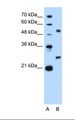 BCL2L1 / BCL-XL Antibody - Lane A: Marker. Lane B: HepG2 cell lysate. Antibody concentration: 2.5 ug/ml. Gel concentration: 12%.  This image was taken for the unconjugated form of this product. Other forms have not been tested.
