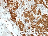 BCL2L15 Antibody - IHC of paraffin-embedded A549 xenograft using BCL2L15 antibody at 1:500 dilution.