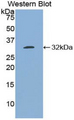 BCL3 / BCL-3 Antibody - Western blot of recombinant BCL3 / BCL-3.