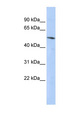 BCL6B Antibody - BCL6B antibody Western blot of HepG2 cell lysate. This image was taken for the unconjugated form of this product. Other forms have not been tested.