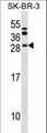 BCL7C Antibody - BCL7C Antibody western blot of SK-BR-3 cell line lysates (35 ug/lane). The BCL7C antibody detected the BCL7C protein (arrow).