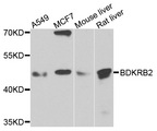 BDKRB2/Bradykinin B2 Receptor Antibody - Western blot analysis of extracts of various cells.