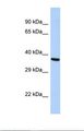 BDNF Antibody - Western blot of Human HepG2. BDNF antibody dilution 1.0 ug/ml.  This image was taken for the unconjugated form of this product. Other forms have not been tested.