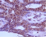 BECN1 / Beclin-1 Antibody - Beclin1 Antibody - Staining of normal breast tissue.  This image was taken for the unconjugated form of this product. Other forms have not been tested.